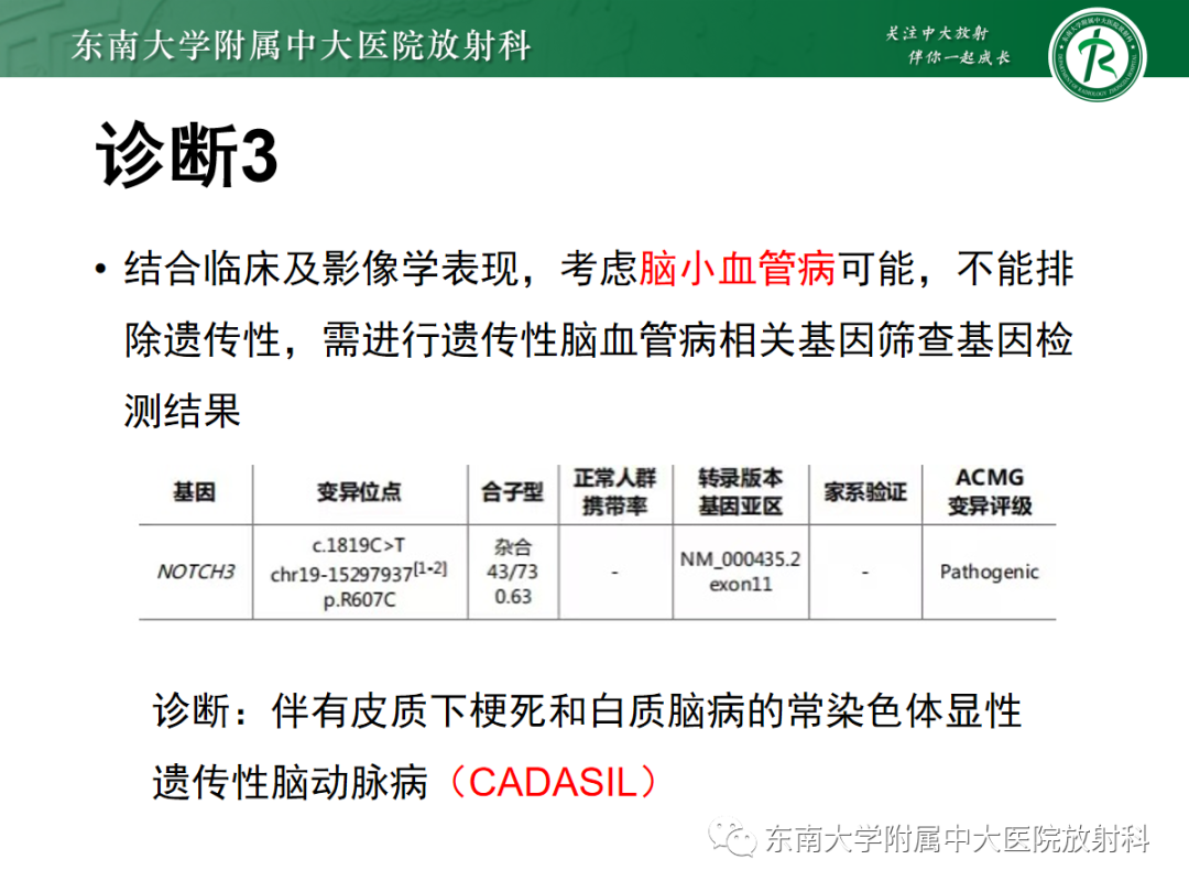 【PPT】皮层下U形纤维受累常见病变-12