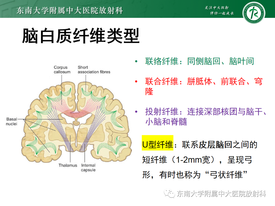 【PPT】皮层下U形纤维受累常见病变-17