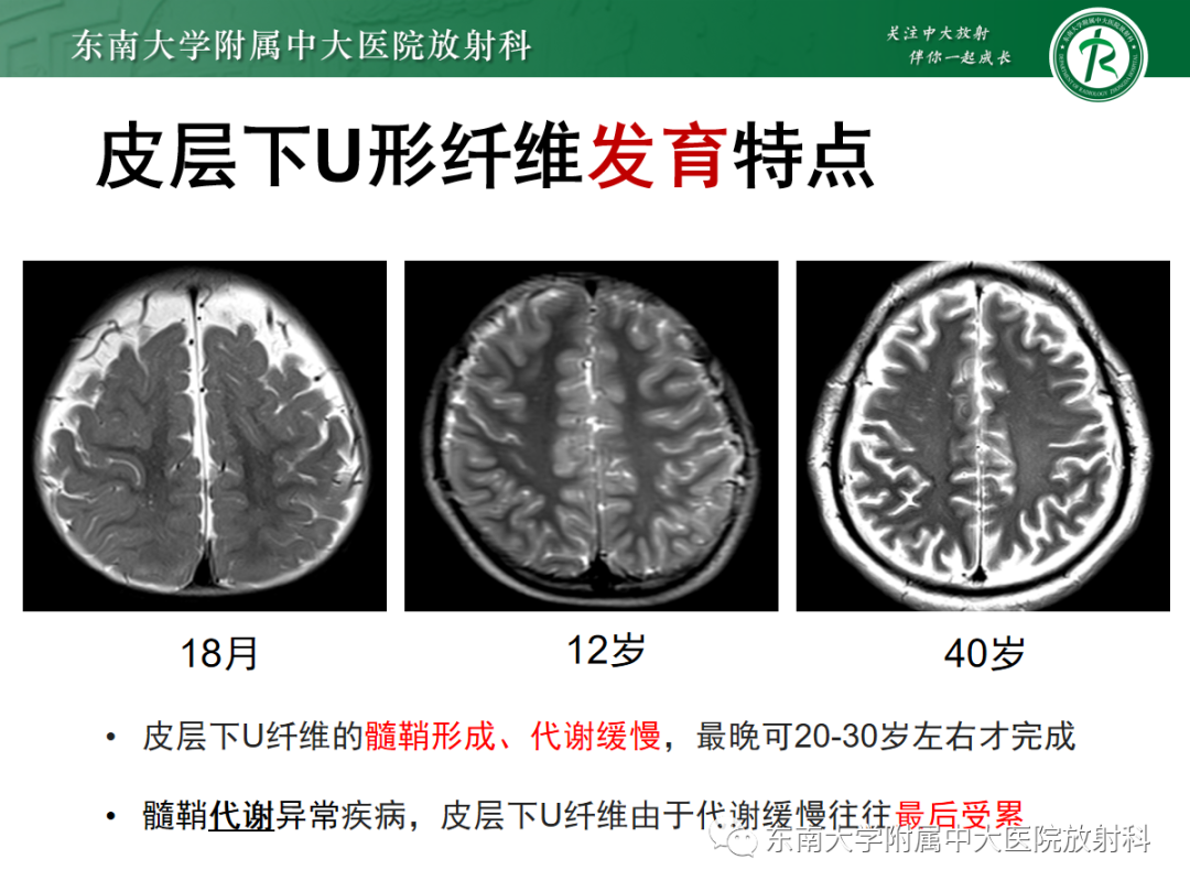 【PPT】皮层下U形纤维受累常见病变-21