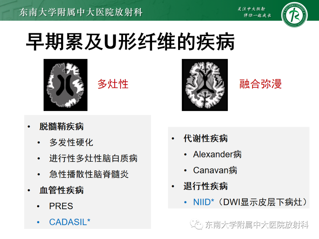 【PPT】皮层下U形纤维受累常见病变-24