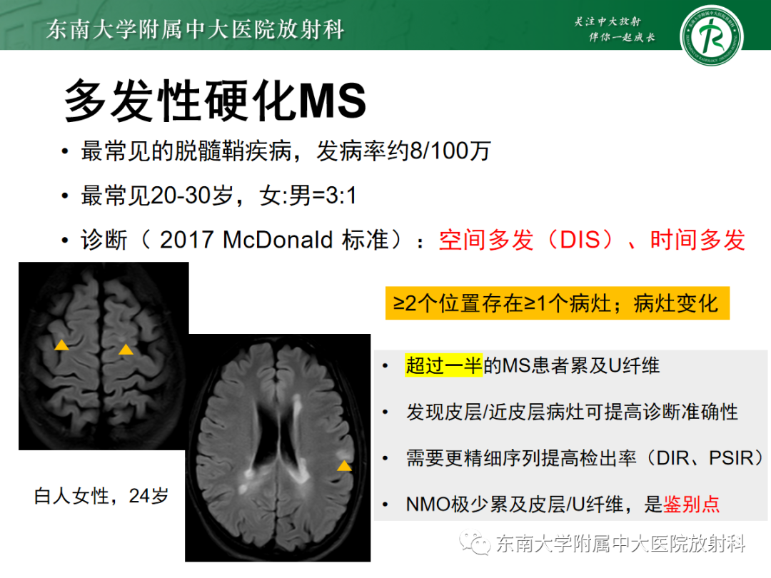 【PPT】皮层下U形纤维受累常见病变-25