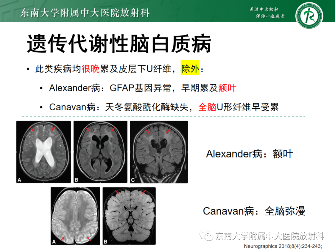 【PPT】皮层下U形纤维受累常见病变-30