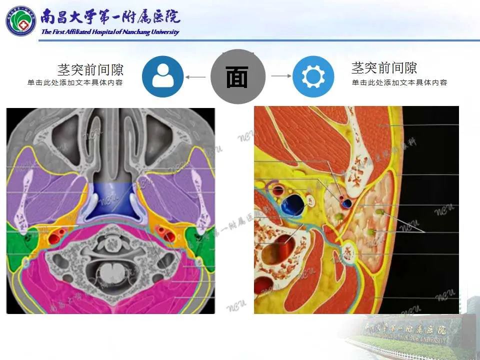 【PPT】咽旁间隙——你别动-25