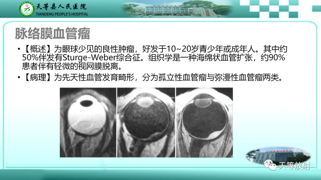 【PPT】眼眶分区及各分区常见疾病-17