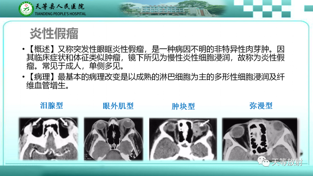 【PPT】眼眶分区及各分区常见疾病-39