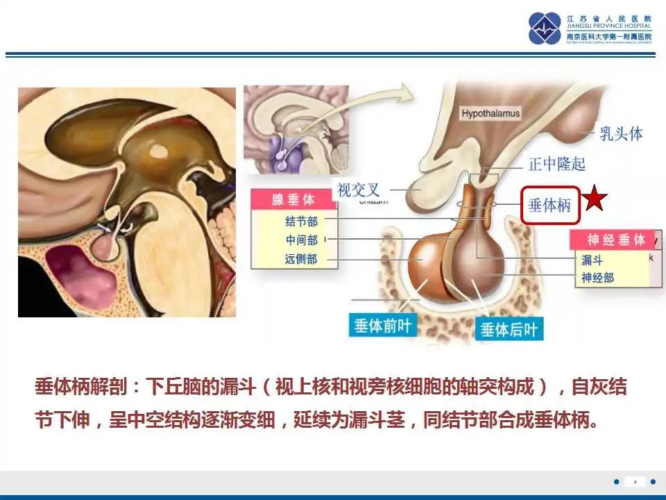 【PPT】垂体细胞瘤-10