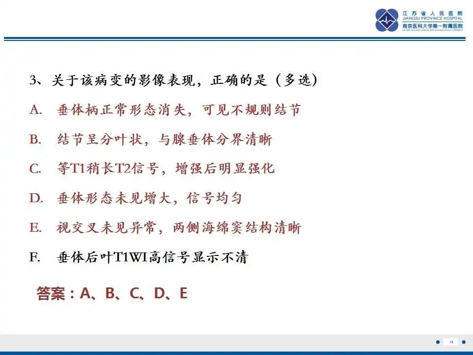 【PPT】垂体细胞瘤-16