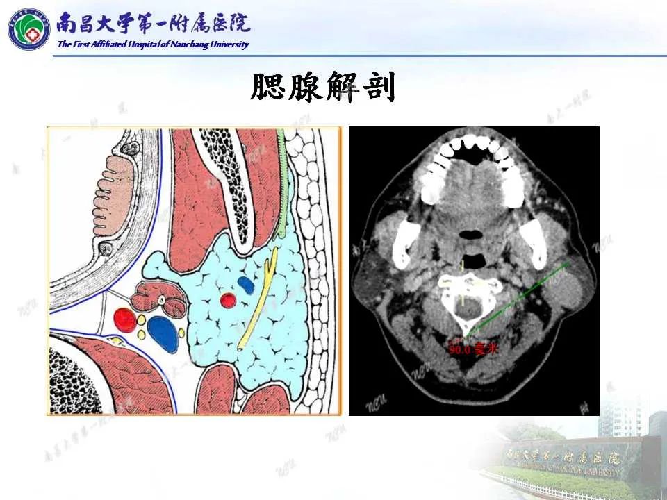 【PPT】腮腺肿瘤CT诊断分析思路-6