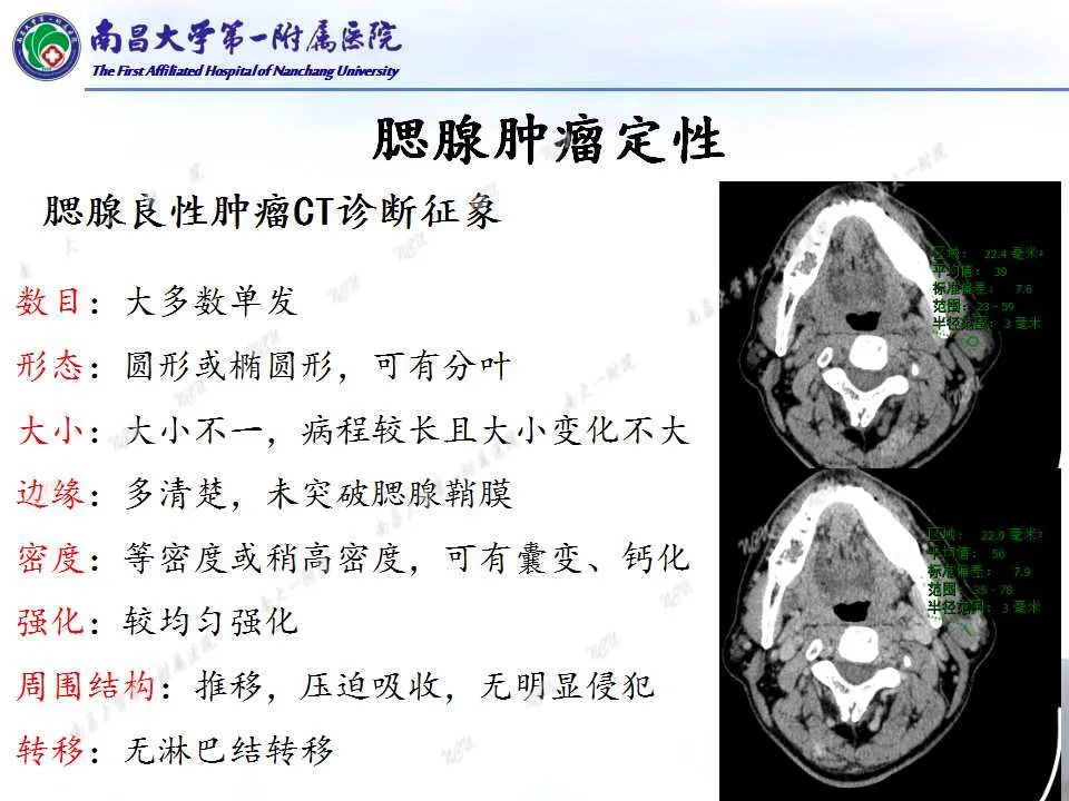 【PPT】腮腺肿瘤CT诊断分析思路-13