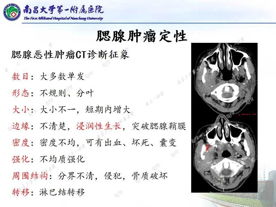 【PPT】腮腺肿瘤CT诊断分析思路-1