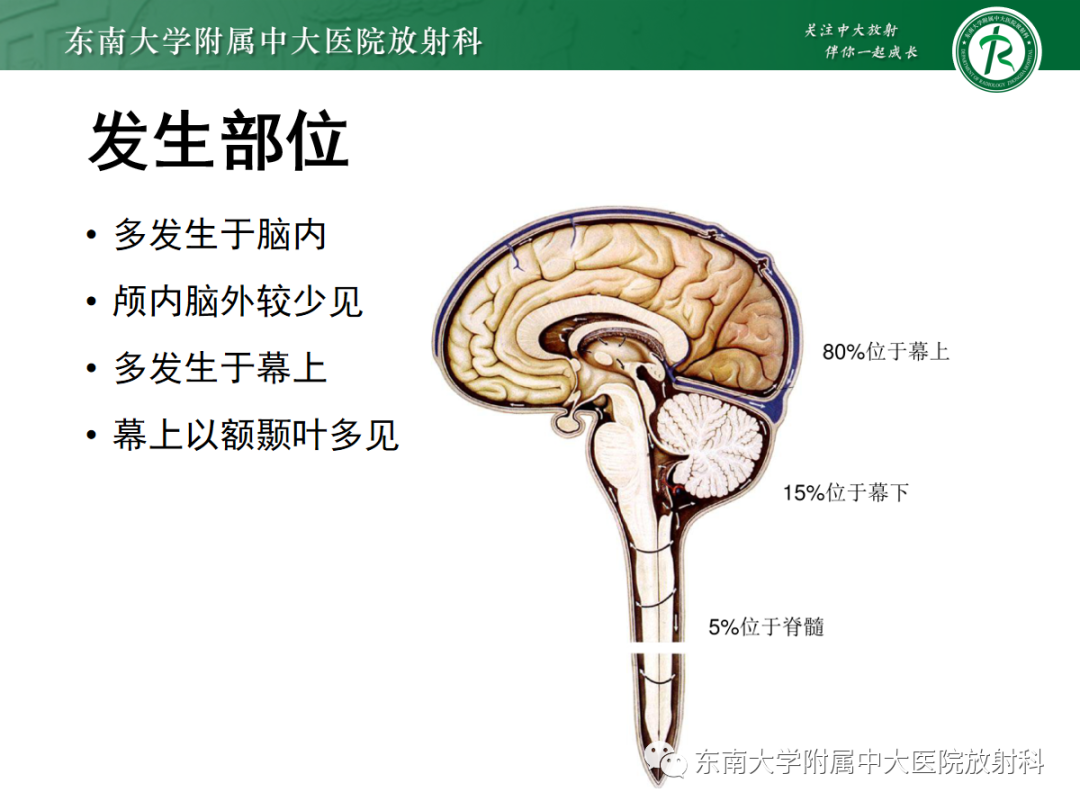 【PPT】颅内海绵状血管畸形-8