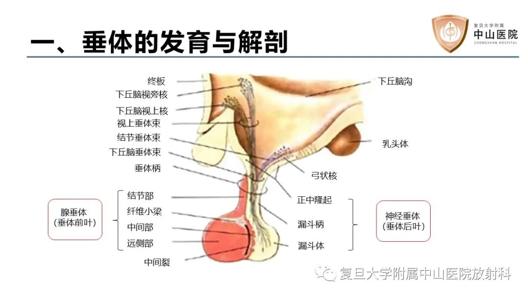 【病例】蝶窦异位垂体腺瘤1例CT及MR-14