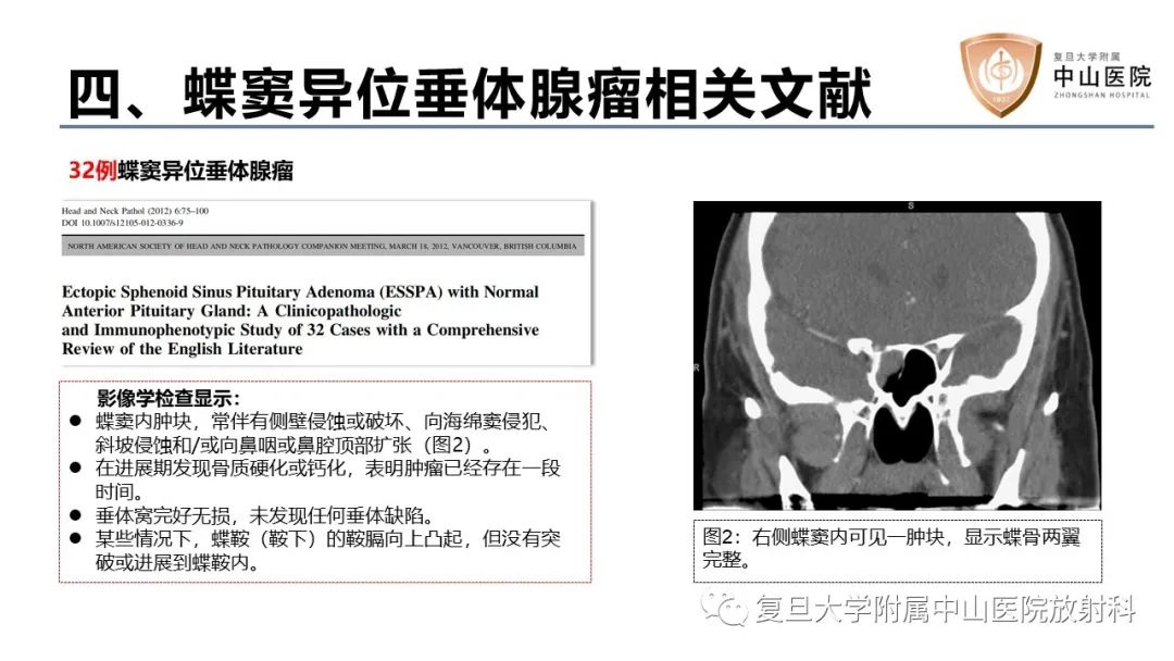 【病例】蝶窦异位垂体腺瘤1例CT及MR-24