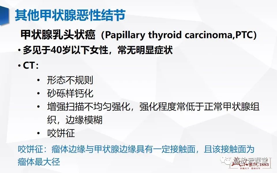 【病例】甲状腺癌1例CT影像鉴别-12