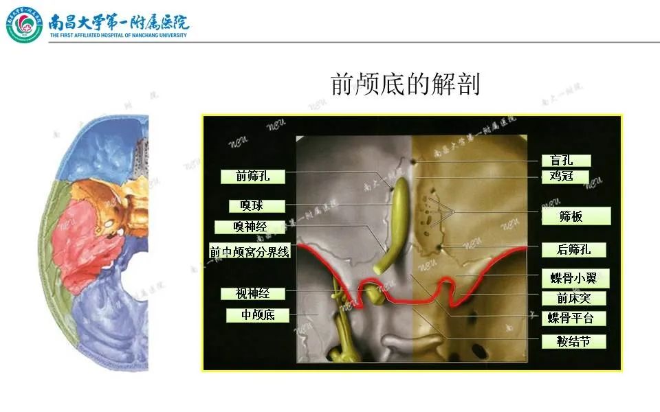 【PPT】颅底肿瘤的影像诊断思路-12