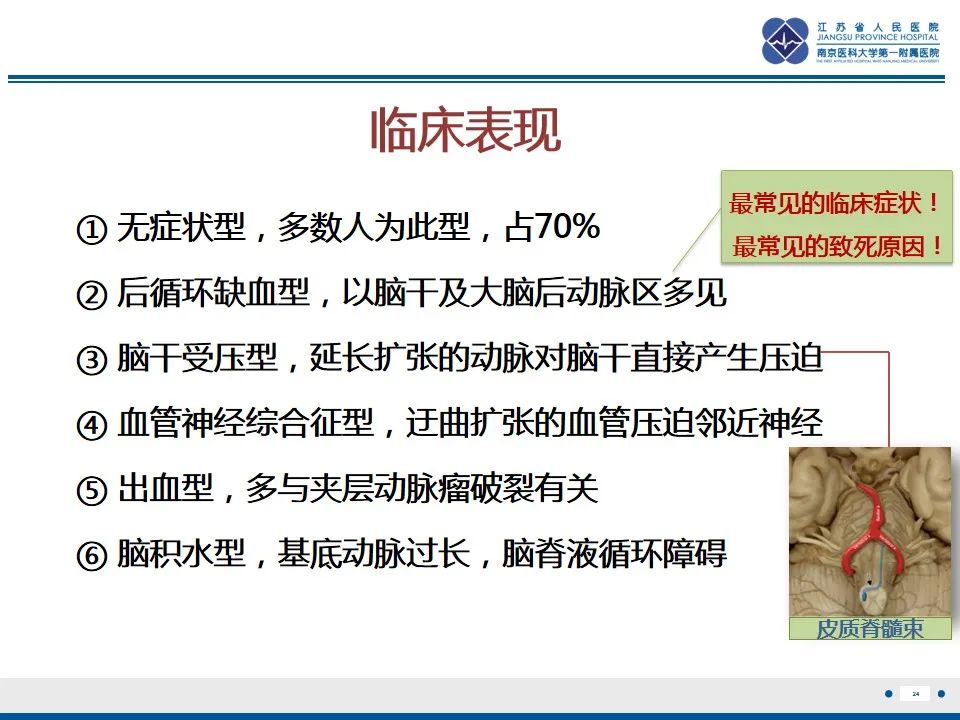 【PPT】椎基底动脉延长扩张症-25