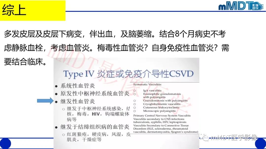 【PPT】系统性红斑狼疮脑病-9