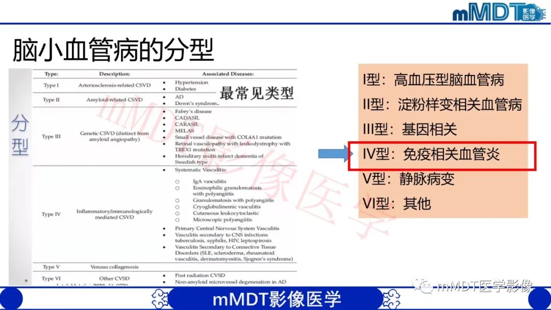 【PPT】系统性红斑狼疮脑病-19