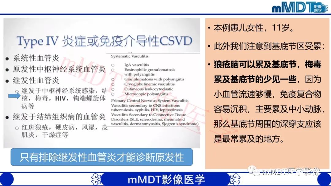 【PPT】系统性红斑狼疮脑病-20