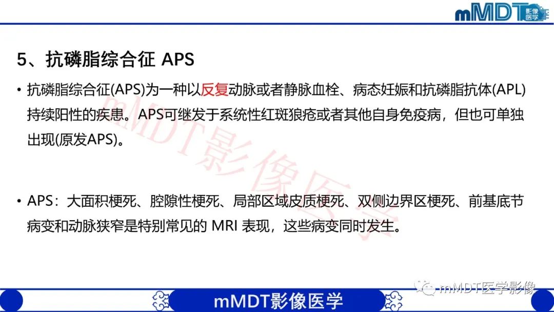 【PPT】系统性红斑狼疮脑病-43