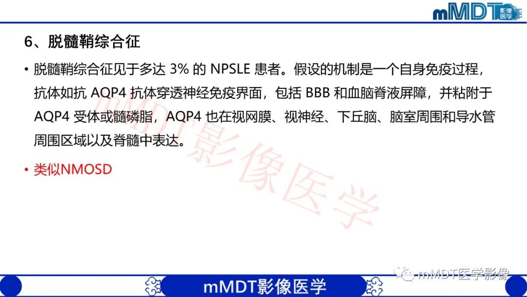 【PPT】系统性红斑狼疮脑病-45