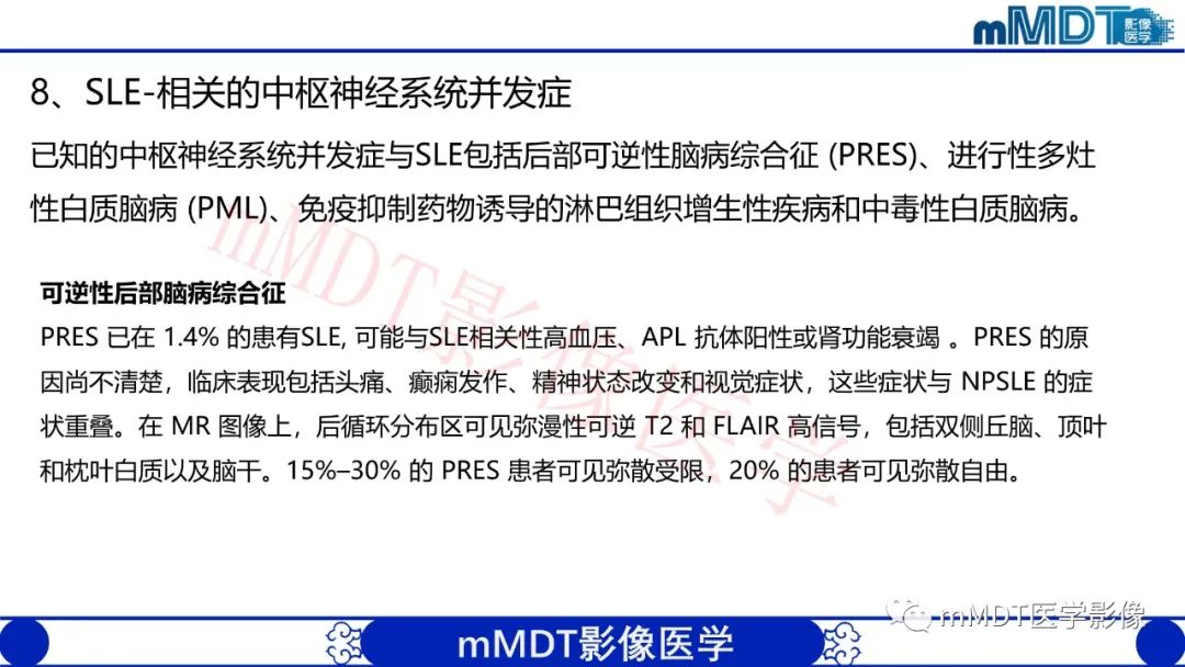 【PPT】系统性红斑狼疮脑病-51