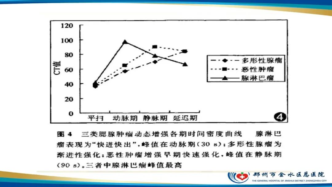 【病例】腮腺多形性腺瘤1例CT影像-30