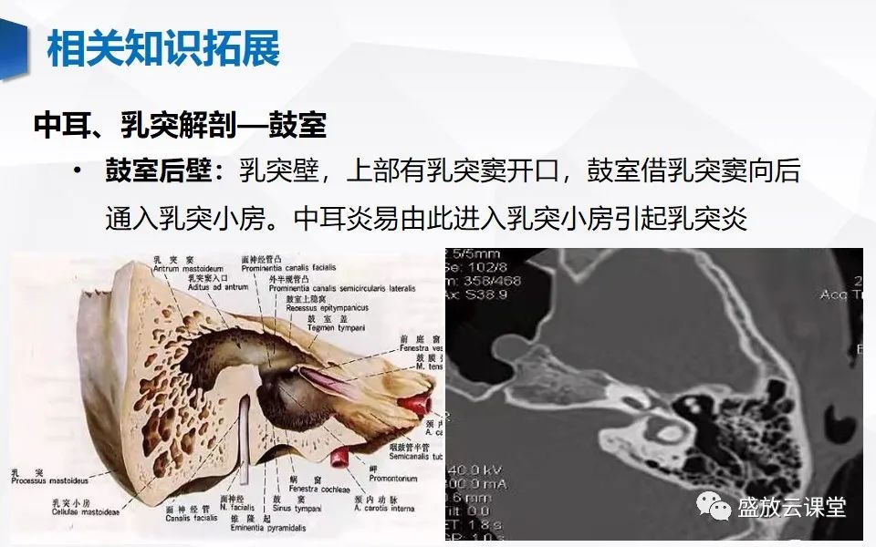 【PPT】中耳乳突解剖及炎症-21