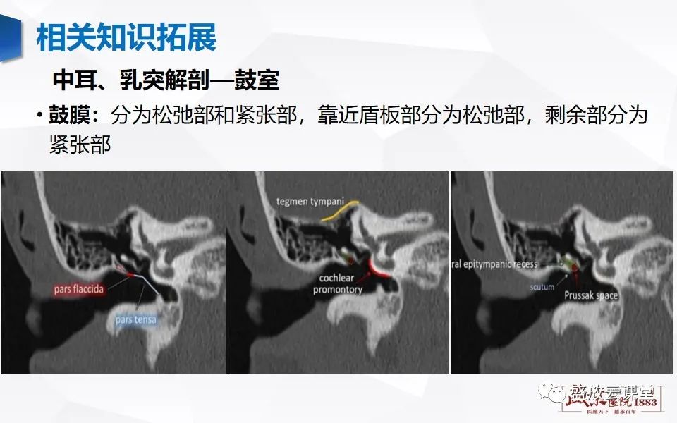 【PPT】中耳乳突解剖及炎症-24