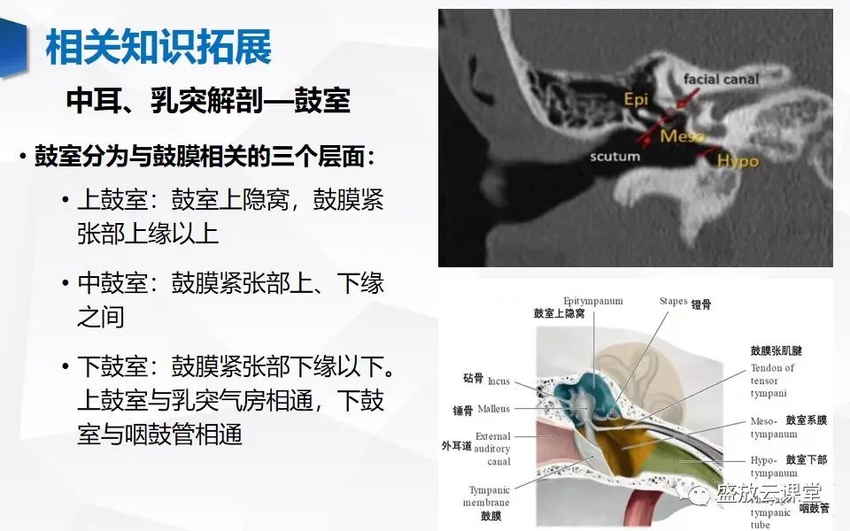 【PPT】中耳乳突解剖及炎症-25