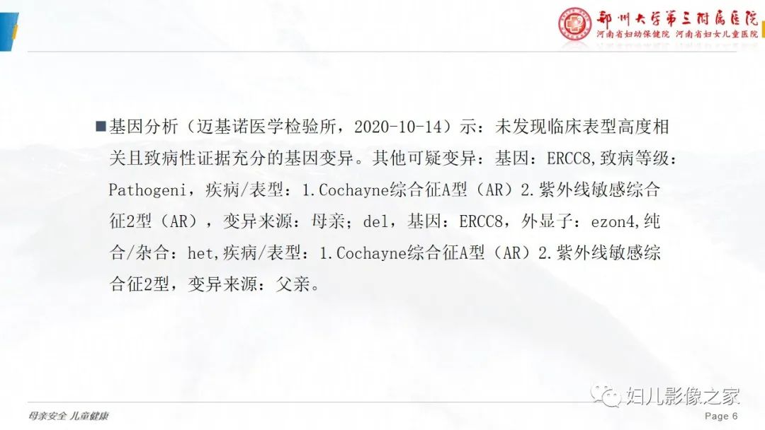 【病例】cockayne综合征1例影像诊断-6