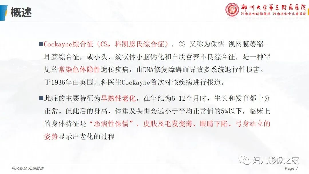 【病例】cockayne综合征1例影像诊断-7