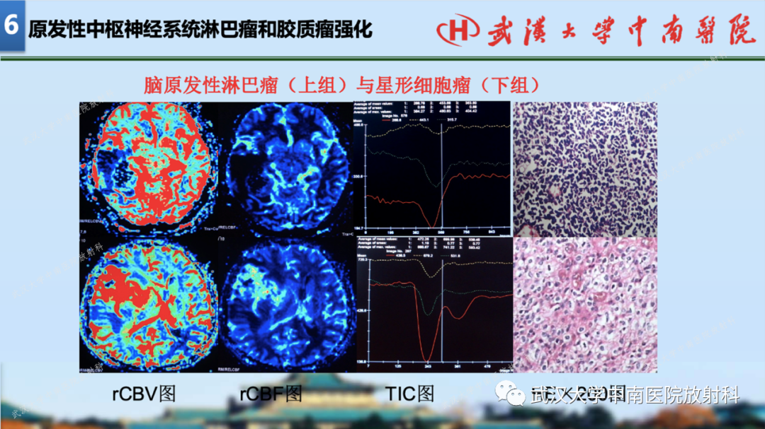 【PPT】局灶性脑部病变影像学诊断-66