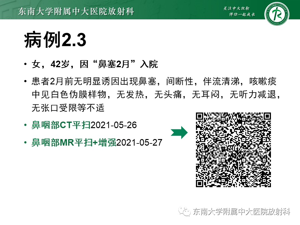 【PPT】鼻咽部占位性病变随访及鉴别-25