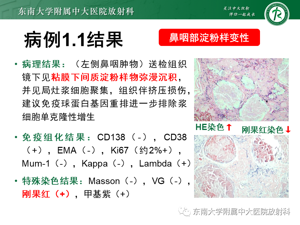 【PPT】鼻咽部占位性病变随访及鉴别-32