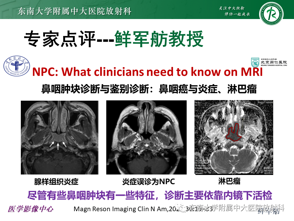 【PPT】鼻咽部占位性病变随访及鉴别-42