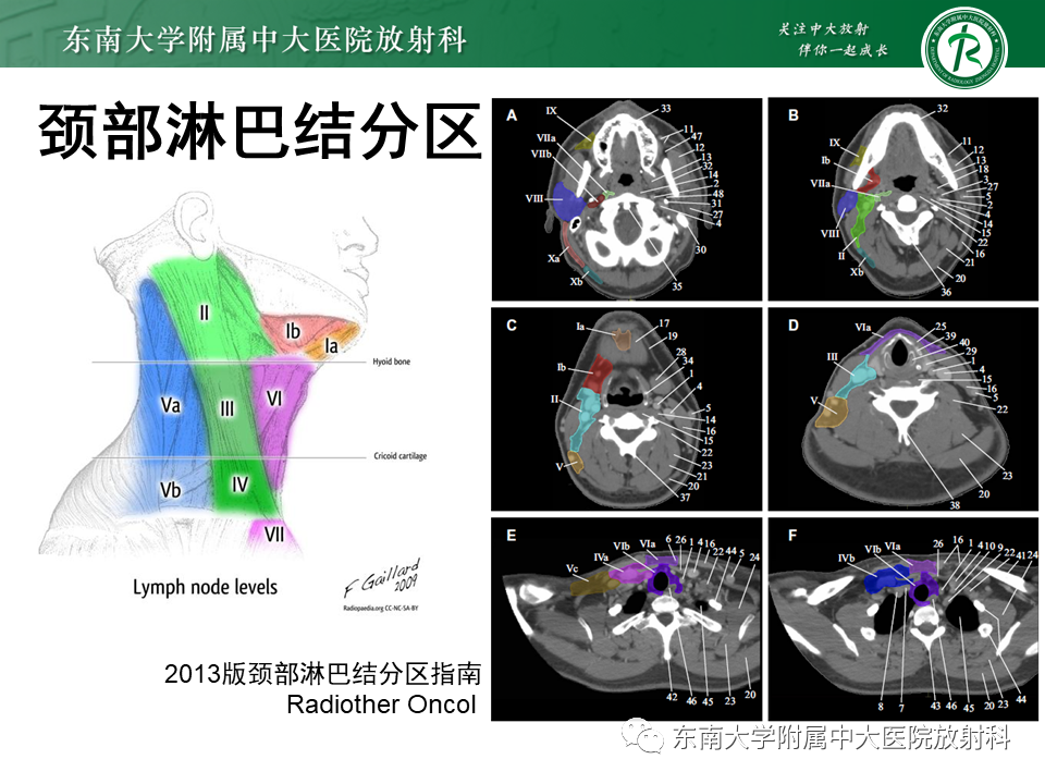 【PPT】鼻咽部占位性病变随访及鉴别-60