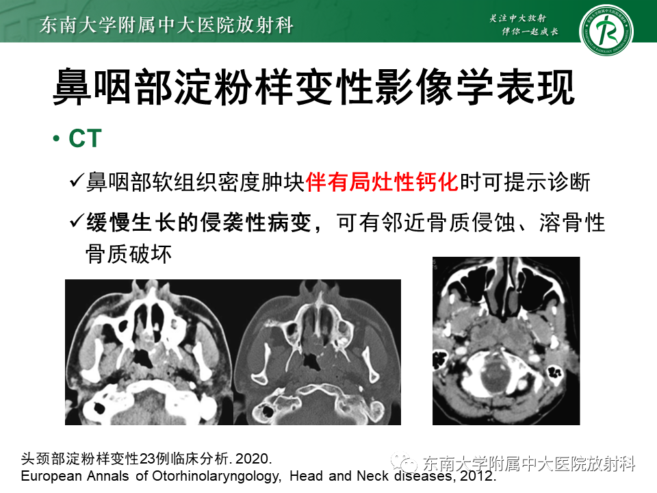 【PPT】鼻咽部占位性病变随访及鉴别-65