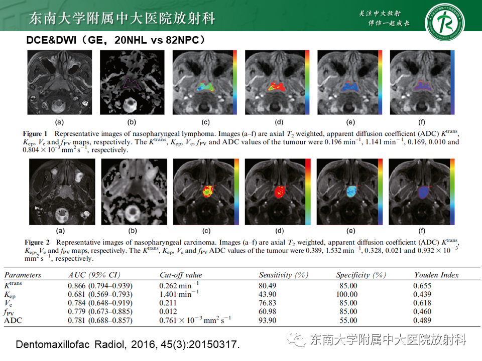 【PPT】鼻咽部占位性病变随访及鉴别-83