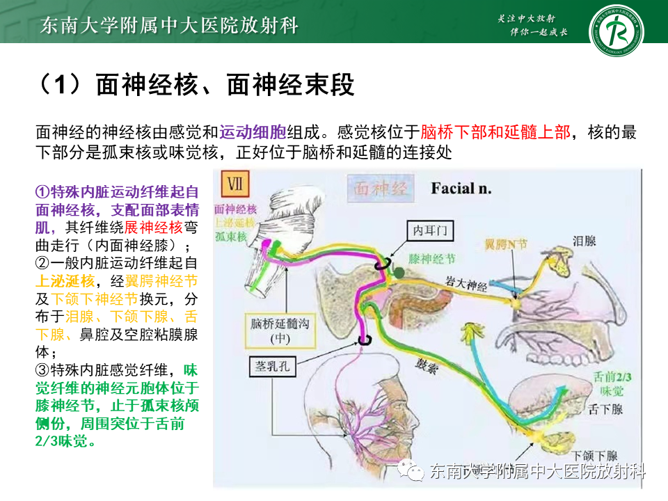 【PPT】面神经解剖及常见病影像学表现-14