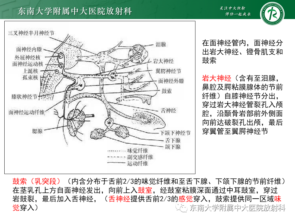 【PPT】面神经解剖及常见病影像学表现-17