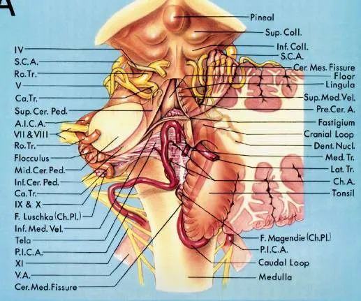 后颅窝三组神经血管复合体的记忆技巧-4