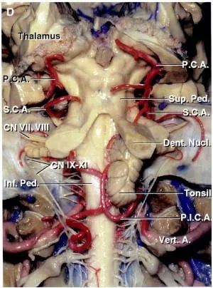 后颅窝三组神经血管复合体的记忆技巧-9