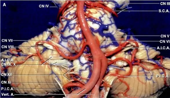 后颅窝三组神经血管复合体的记忆技巧-2