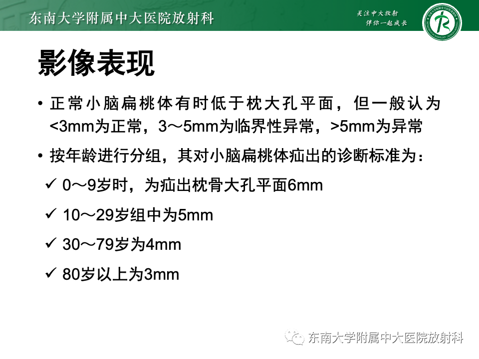 【PPT】小脑扁桃体下疝畸形-9