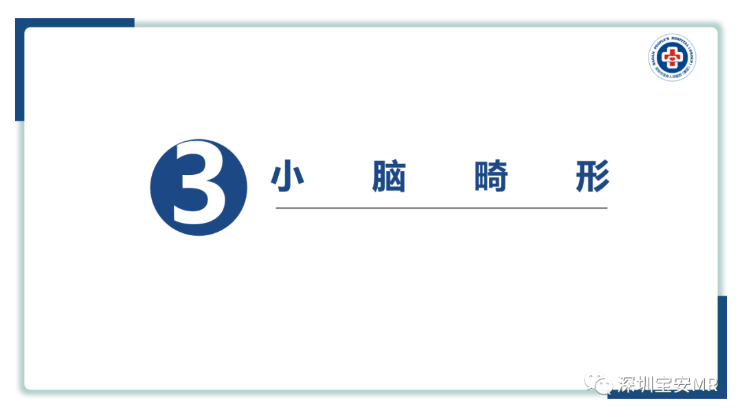 【PPT】后颅窝畸形-12