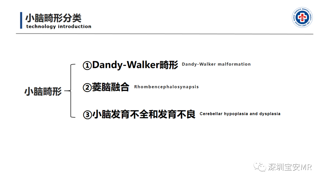 【PPT】后颅窝畸形-13