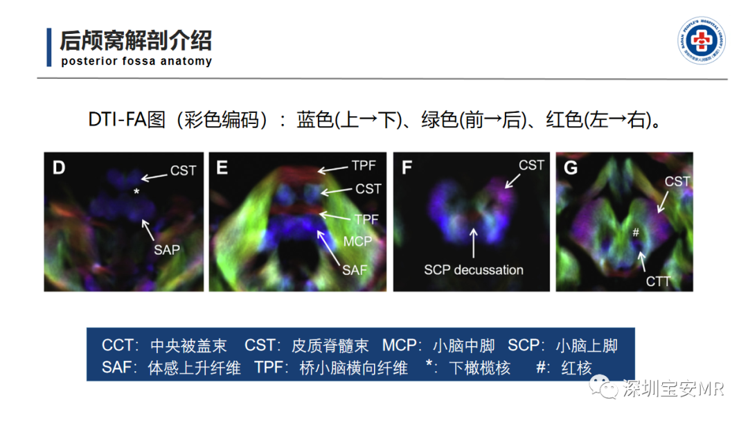 【PPT】后颅窝畸形-6