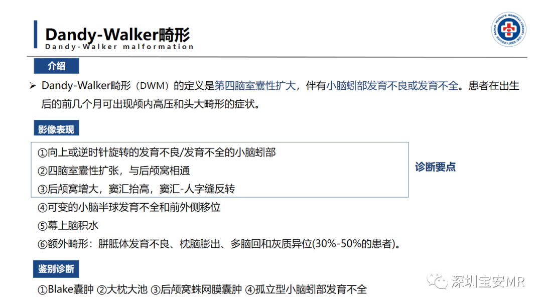 【PPT】后颅窝畸形-14