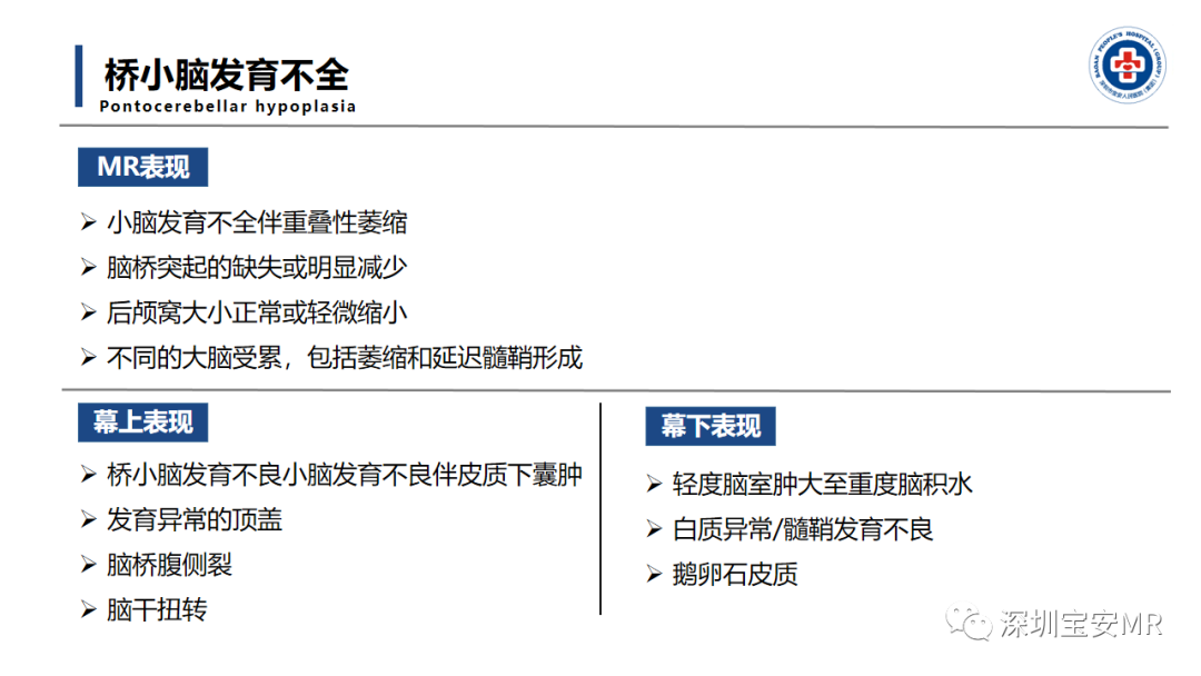 【PPT】后颅窝畸形-29